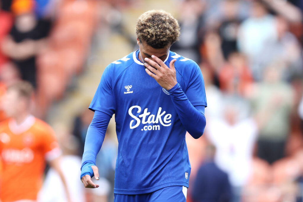 Dele Alli mit Hand vor Gesicht